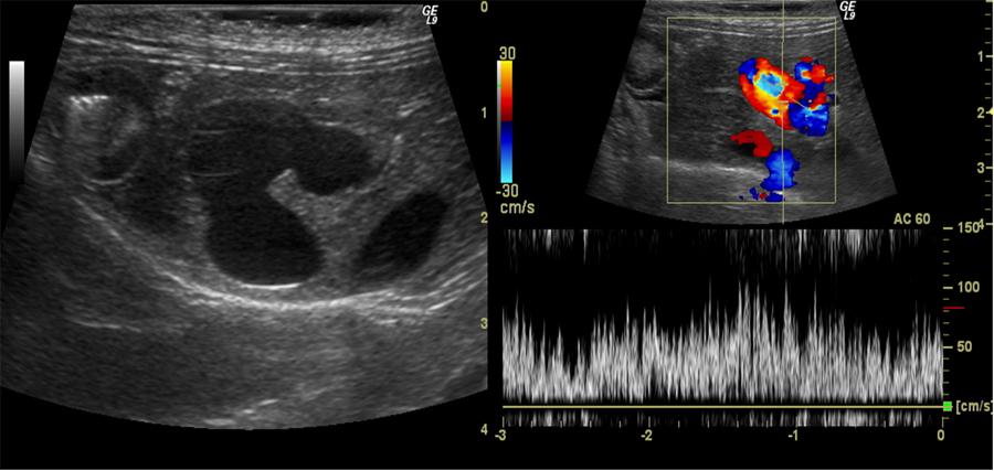 The Effect Of Ultrasound Imaging On The